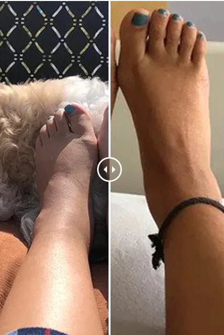 Orthopedic Neuro Socks - Pain/Swelling Healing Socks - (BUY 1 GET 1 FREE)(4.9 ⭐⭐⭐⭐⭐ 15,320 REVIEWS)