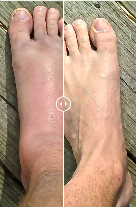 Orthopedic Neuro Socks - Pain/Swelling Healing Socks - (BUY 1 GET 1 FREE)(4.9 ⭐⭐⭐⭐⭐ 15,320 REVIEWS)